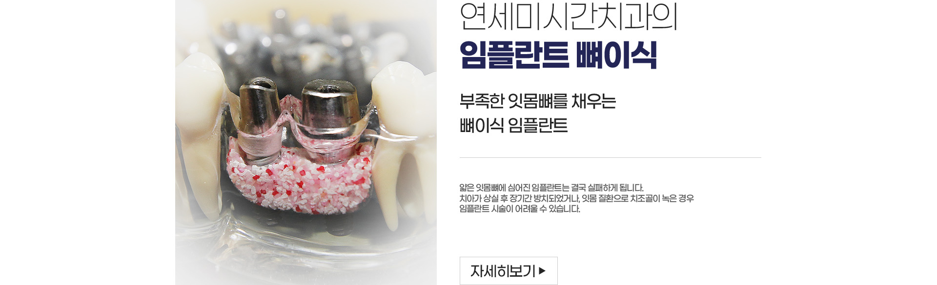 ���ö�Ʈ ���̽�