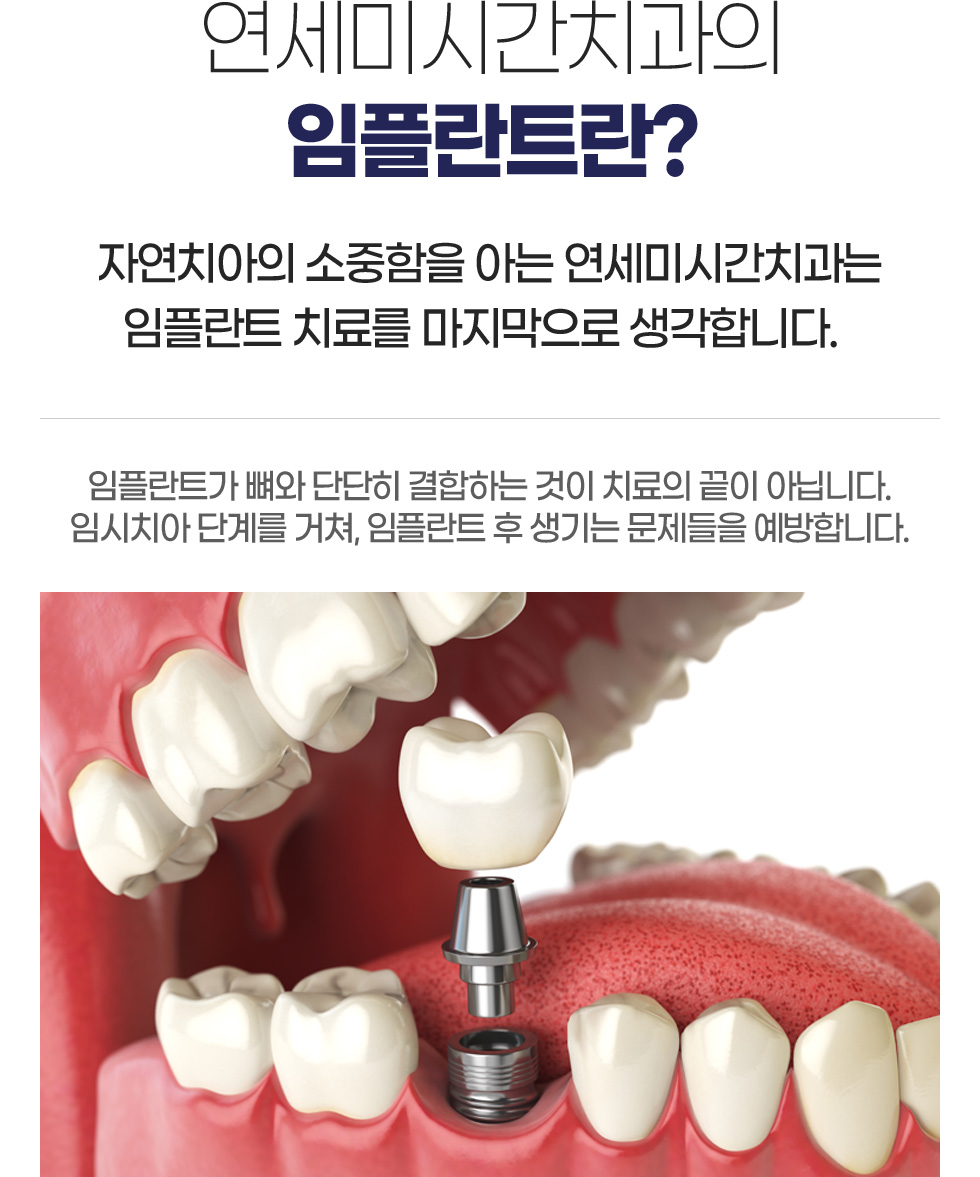 �����̽ð����� ���ö�Ʈ