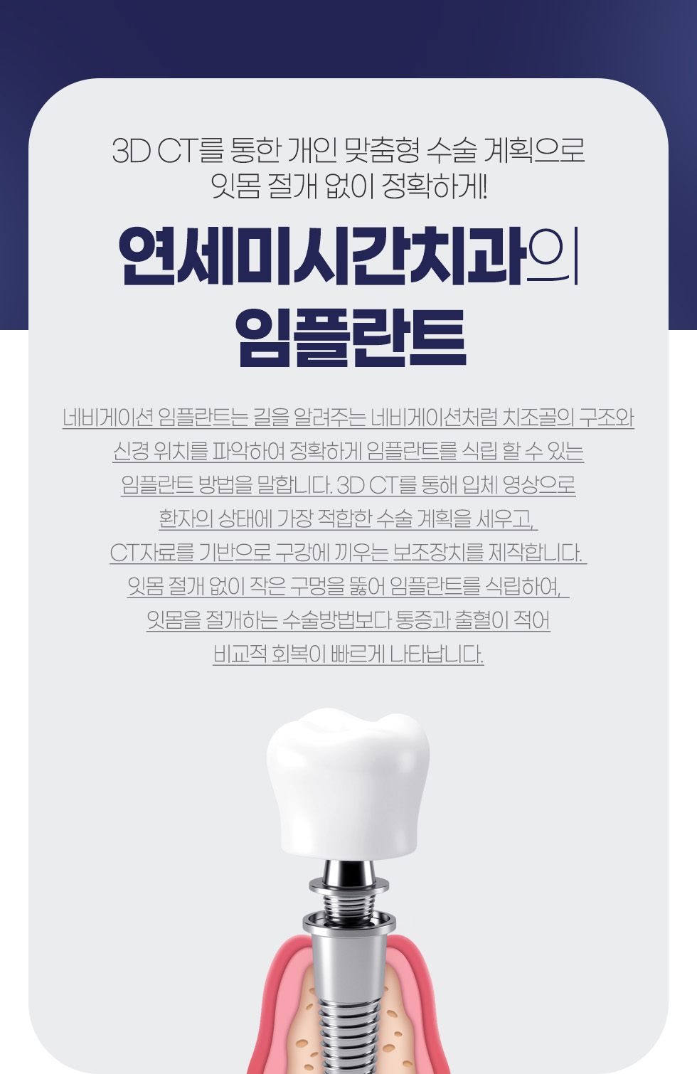 �����̽ð�ġ���� ���ö�Ʈ