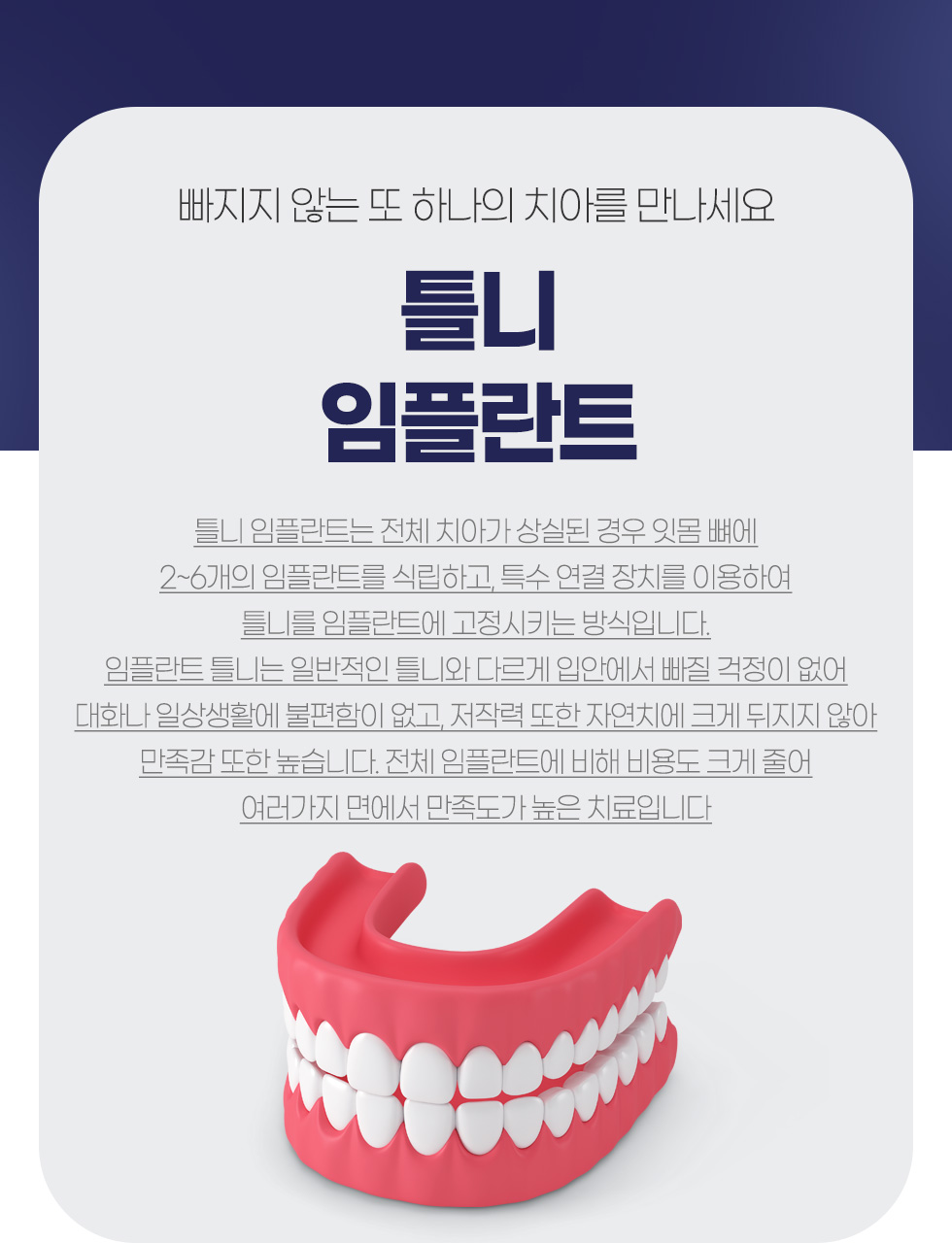 �׺���̼� ���ö�Ʈ ����