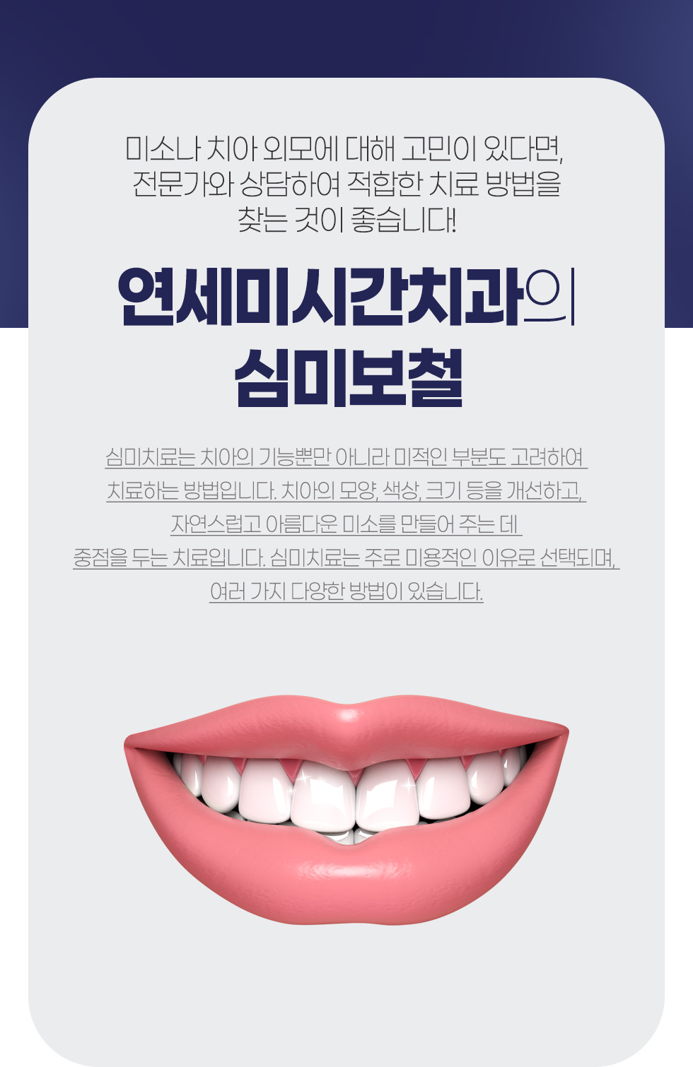 �����̽ð�ġ���� �ɹ̺�ö