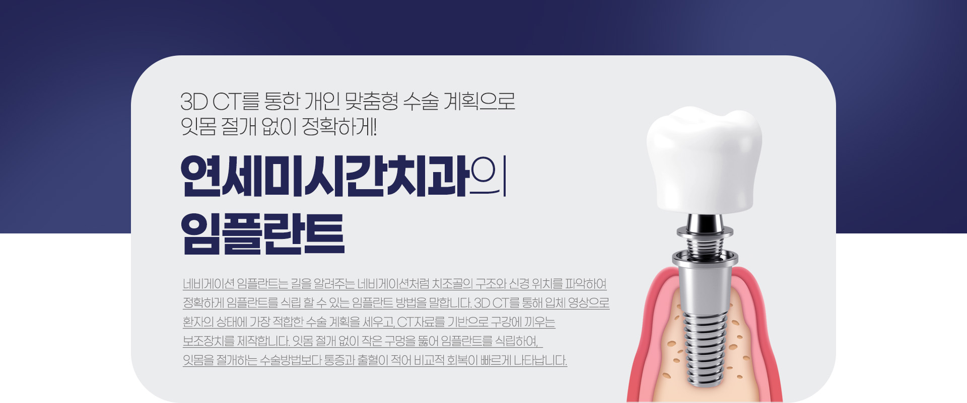 �����̽ð�ġ���� ���ö�Ʈ