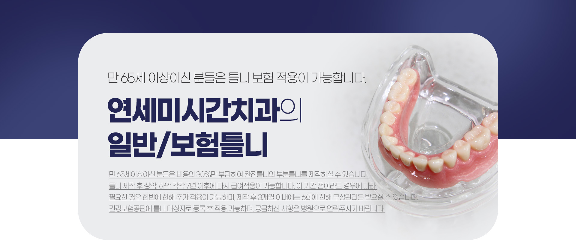 �����̽ð�ġ���� �Ϲ�/����Ʋ��